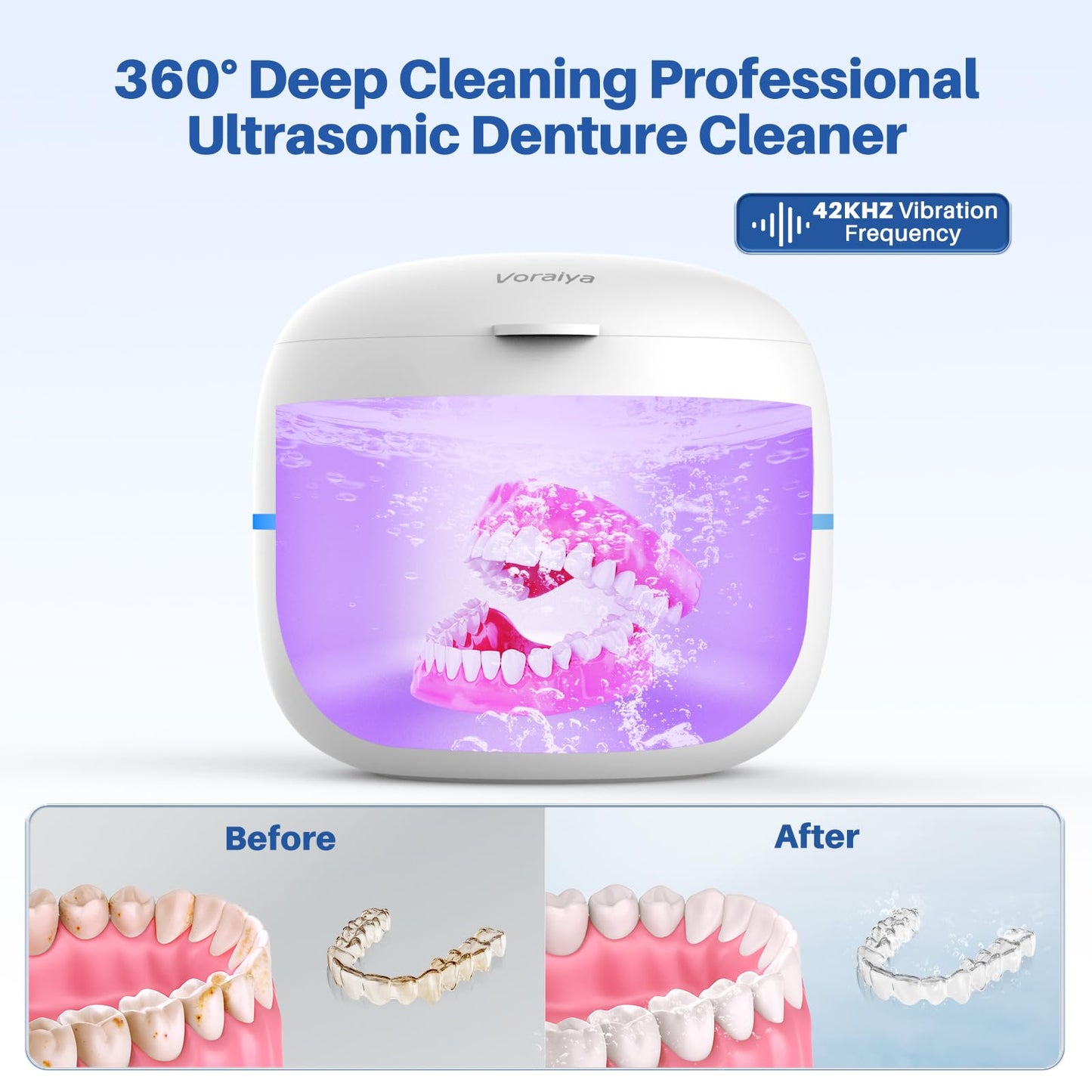 Voraiya Ultrasonic Retainer Cleaner – Dentures, Retainers, Jewelry, 2 Modes