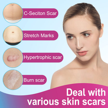 Vortexonix Silicone Scar Sheets | Medical-Grade Soft Silicone Tape (1.6” x 75” / 1.9m)