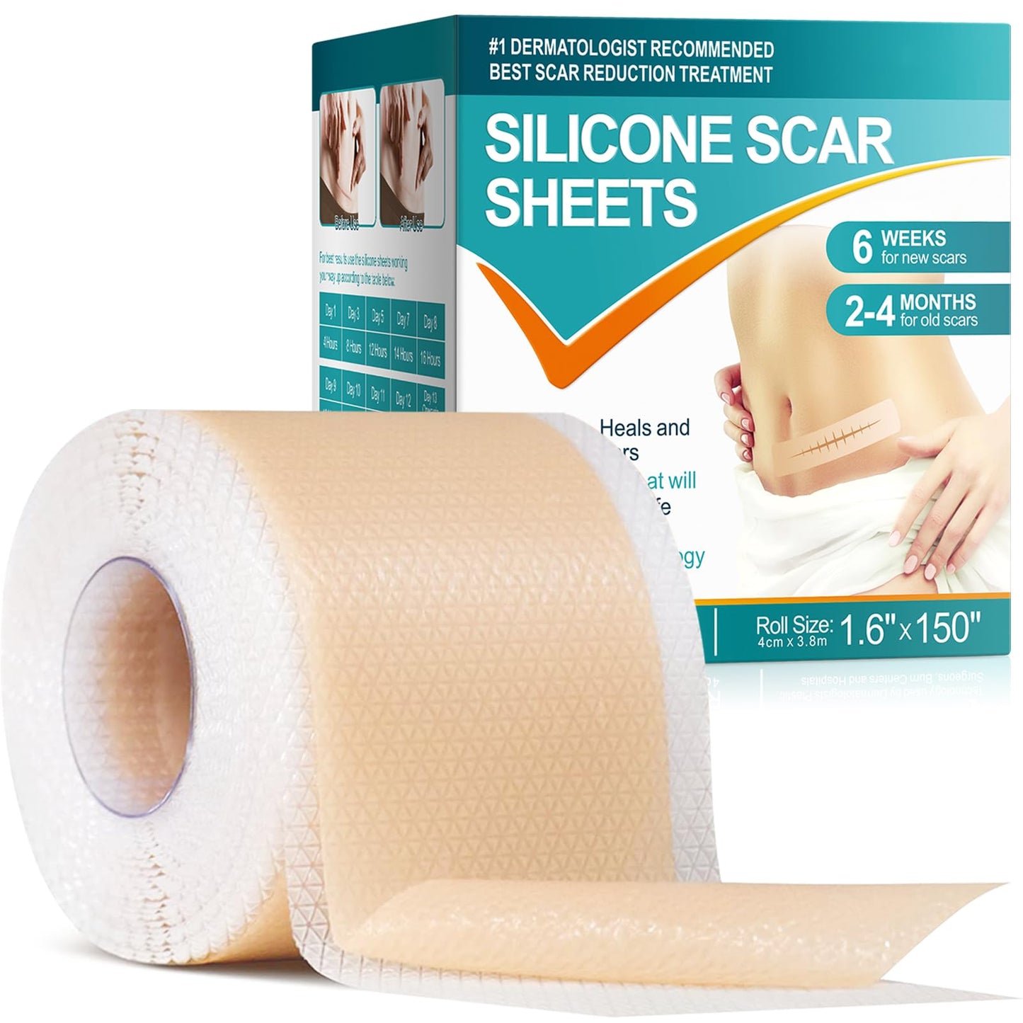 Vortexonix Silicone Scar Sheets – Medical-Grade Soft Silicone Scar Tape (1.6in x 150in, approx. 3.8m)