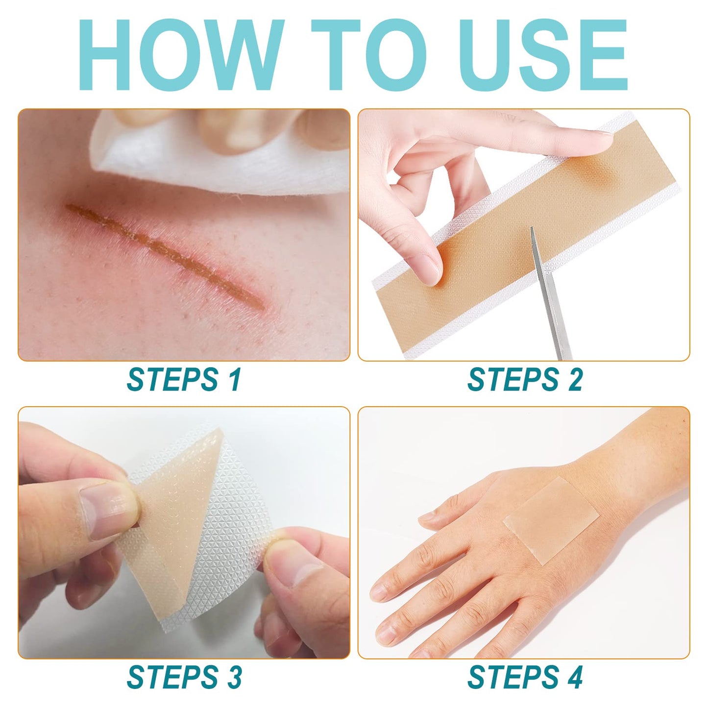 Vortexonix Silicone Scar Sheets – Medical-Grade Soft Silicone Scar Tape (1.6in x 150in, approx. 3.8m)