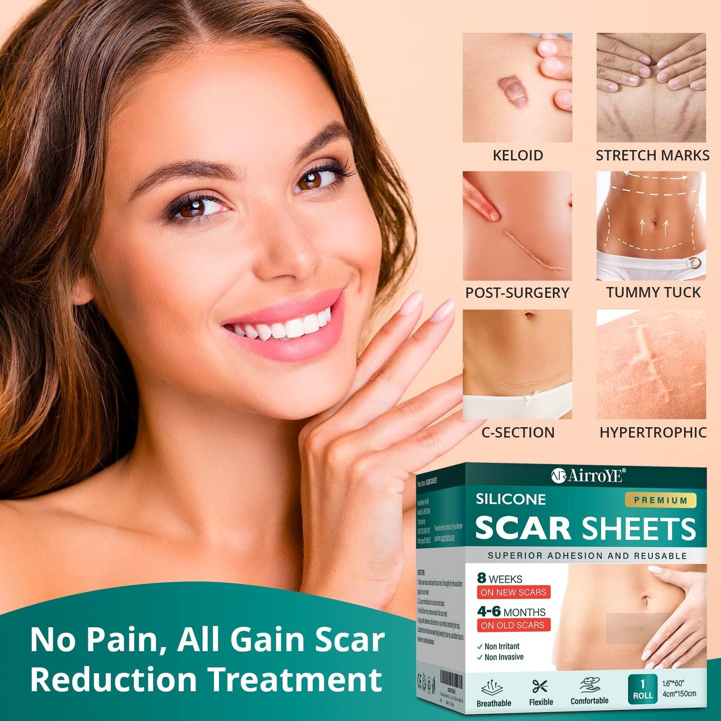 Vxoyo Silicone Scar Sheets — Reusable 1.6x60 Roll for Scar Care (Surgical, Keloid, Burns)