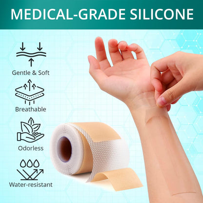 Vxoyo Silicone Scar Sheets — Reusable 1.6x60 Roll for Scar Care (Surgical, Keloid, Burns)