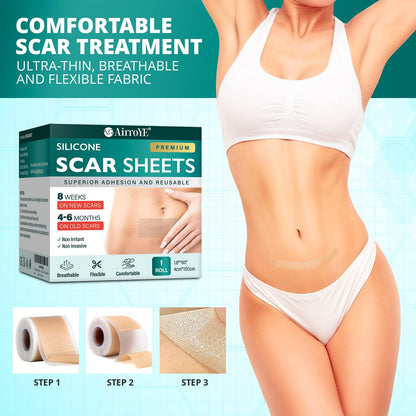 Vxoyo Silicone Scar Sheets — Reusable 1.6x60 Roll for Scar Care (Surgical, Keloid, Burns)