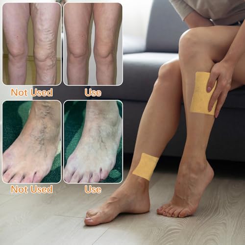 Wanban 48 PCS Turmeric Varicose Vein Patch – Natural Leg Relief