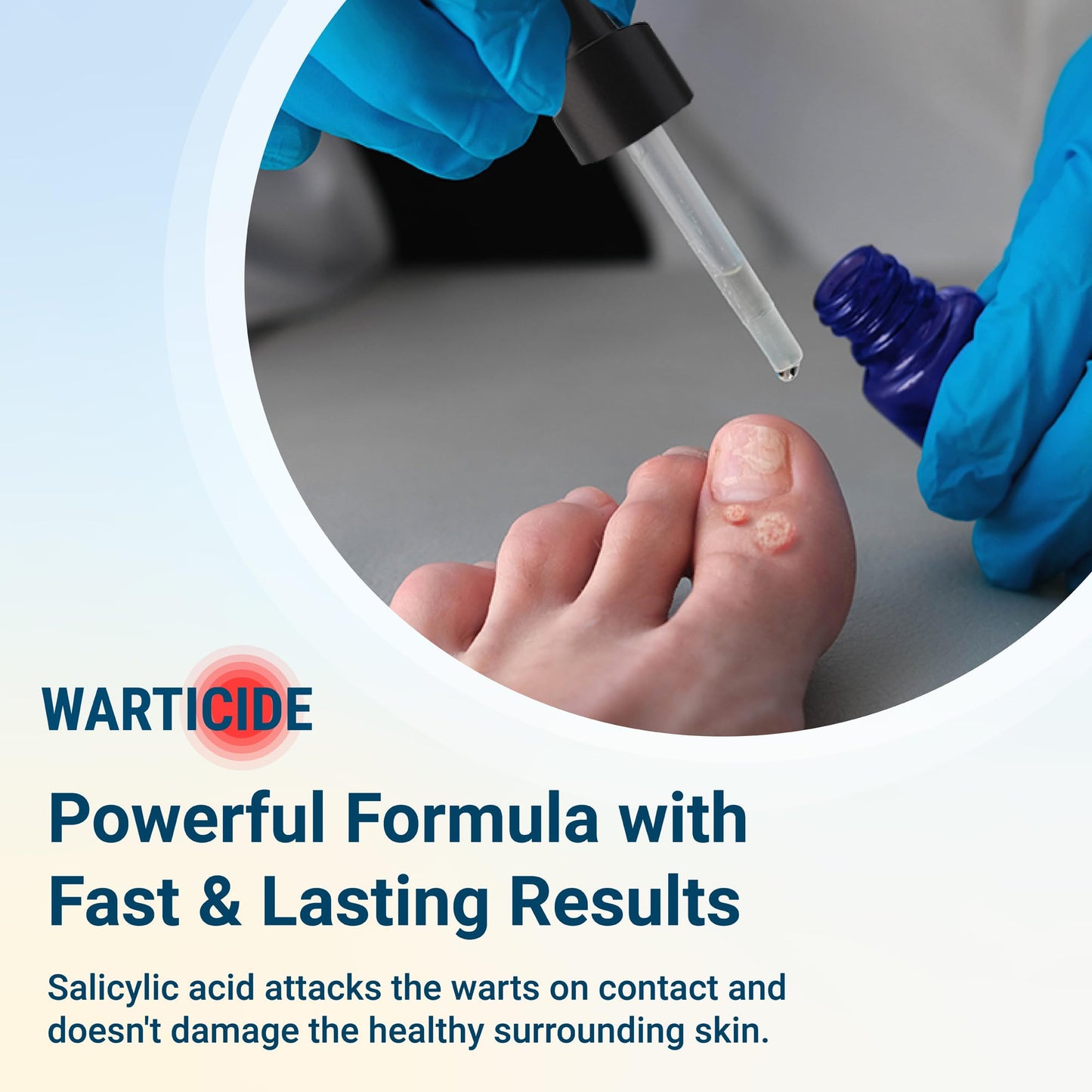 Warticide Liquid Wart Remover – 10% Salicylic Acid with Tea Tree & Cedar Leaf Oil | Made in USA | 1 Fl Oz Dropper