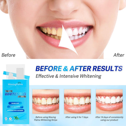 Waving Palms Teeth Whitening Strips – 28 Strips, Enamel-Safe, Quick 14-Day Whitening