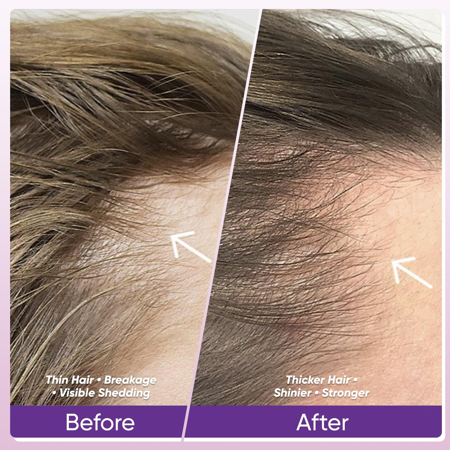WGYPEU Hair Growth Vitamins | Biotin 10,000mcg, Collagen & Multivitamin