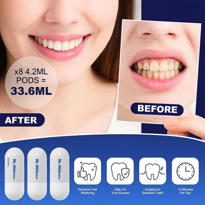 Mr. Whitener LED Teeth Whitening Kit – Dentists Recommended, Enamel Safe, Sensitive Teeth, 8 Refill Pods (33.6ml)