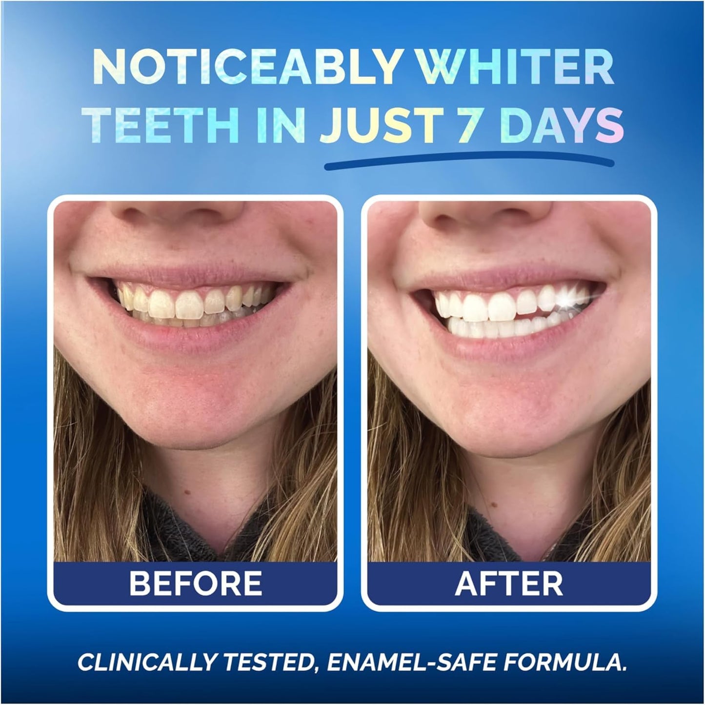 Whitening Strips for Sensitive Teeth – Enamel Safe, Peroxide-Free & Coconut Oil