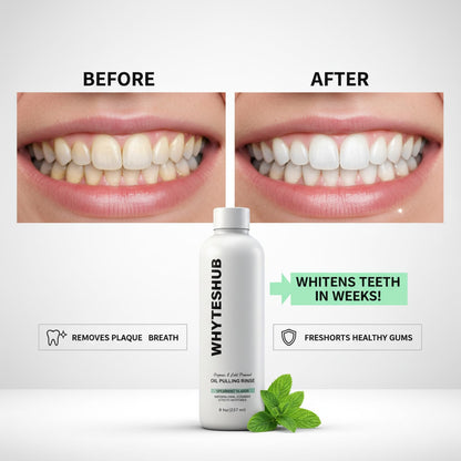 Whyteshub Spearmint Oil Pulling Rinse – Organic Coconut Oil Mouthwash (8 oz)