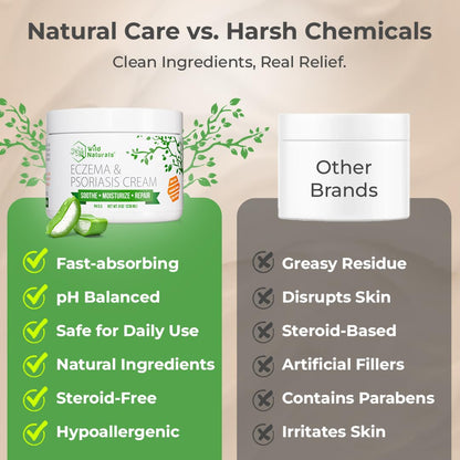 Wild Naturals Eczema & Psoriasis Cream — Manuka Honey + Aloe, Hydrating Lotion for Dry Skin (Adults & Kids)