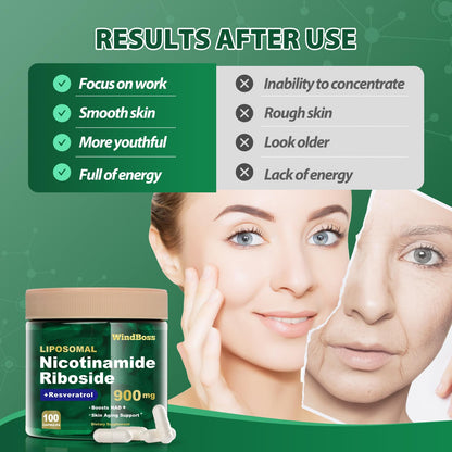 Windboss Liposomal NAD+ Supplement with NR & Resveratrol – NAD Booster for Cellular Energy, Anti-Aging, Metabolism (2pcs)