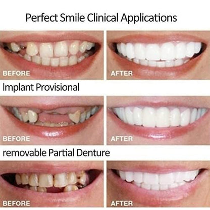 2 Pairs Temporary Smile Supports - Top & Bottom, Natural White, Comfortable