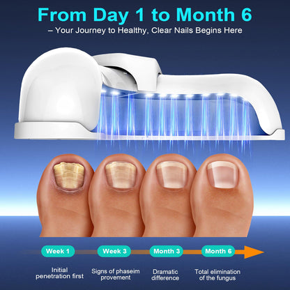 XiNanc Nail Fungus Laser Treatment LED Light Device | Rechargeable Toenail Light Therapy