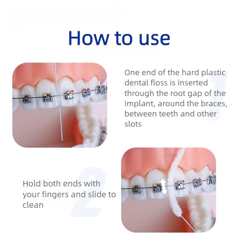YANDY Dental Floss for Braces – 200 Count, Threaders for Implants & Bridges