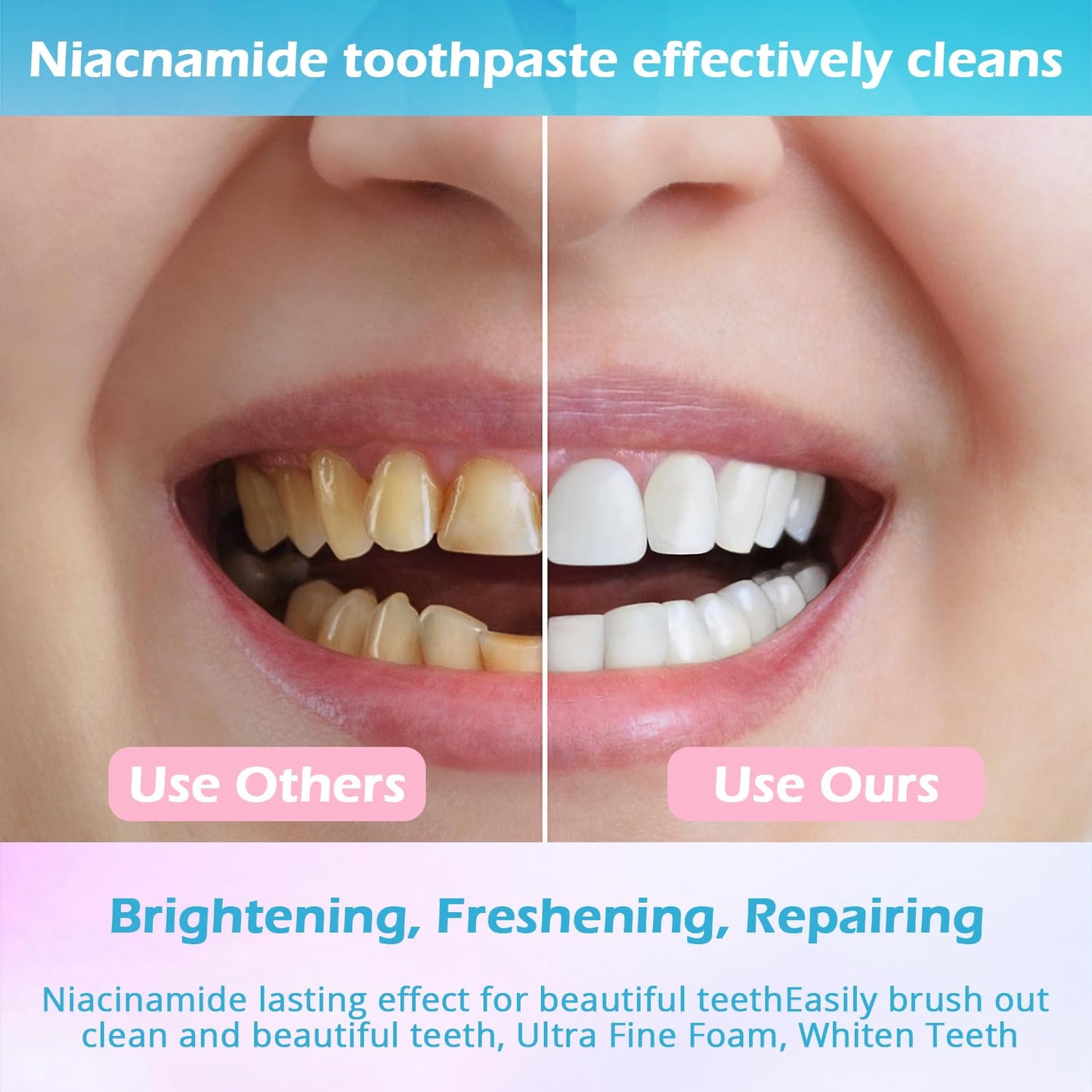 Niacinamide Whitening Toothpaste – Enamel Protection & Stain Removal (Mint) | 1 Pack | YanxiananYagao