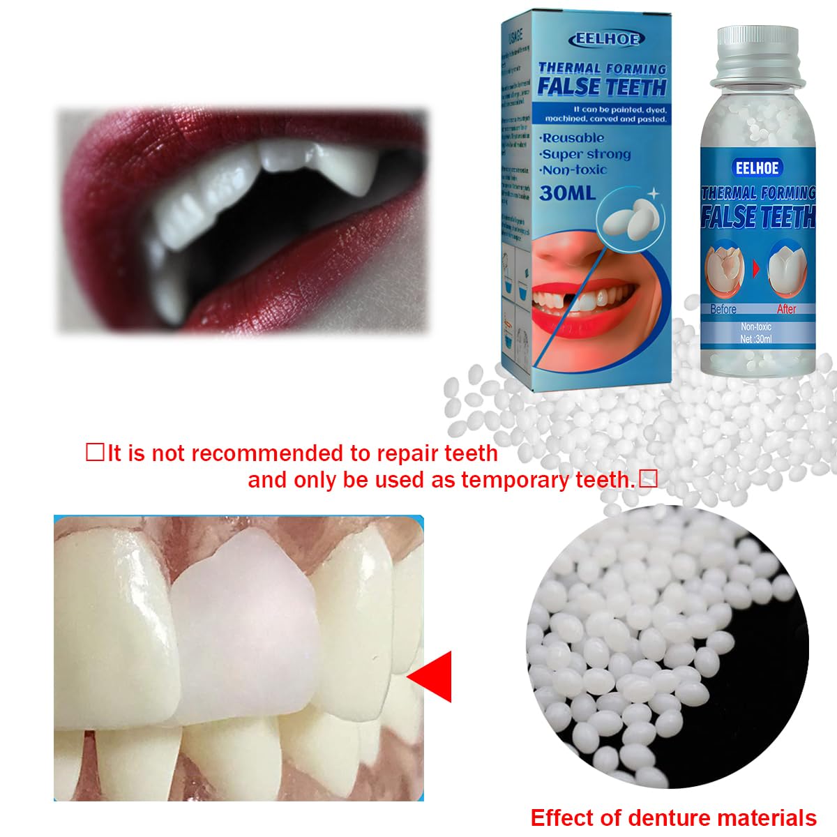 Yuehao Temporary Tooth Repair Kit – DIY Play Dough, Safe Dental Restoration, 30ml Bottle