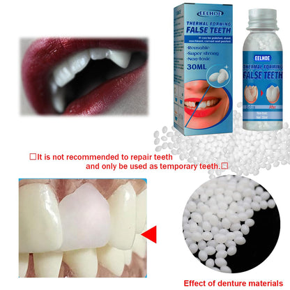 Yuehao Temporary Tooth Repair Kit – DIY Play Dough, Safe Dental Restoration, 30ml Bottle