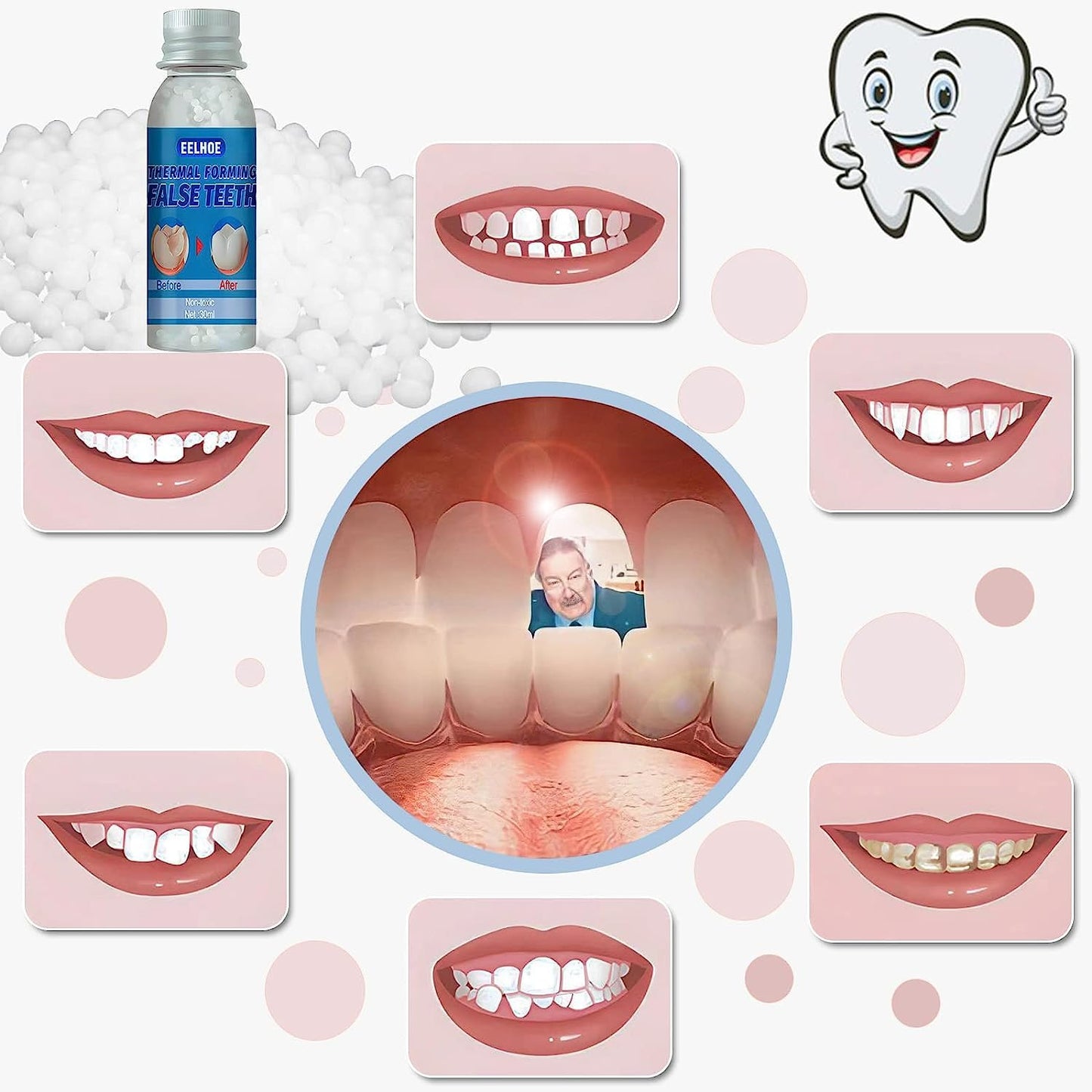 Yuehao Temporary Tooth Repair Kit – DIY Play Dough, Safe Dental Restoration, 30ml Bottle