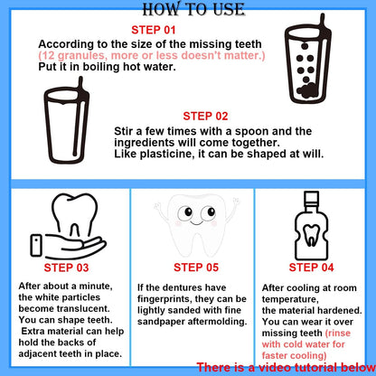 Yuehao Temporary Tooth Repair Kit – DIY Play Dough, Safe Dental Restoration, 30ml Bottle