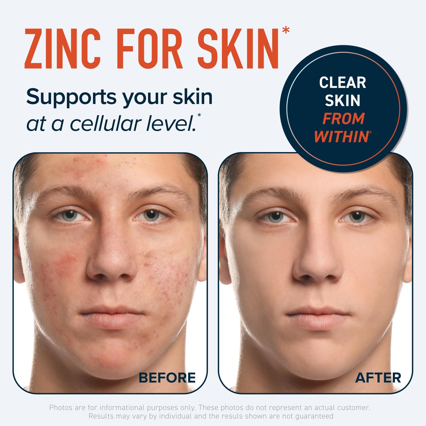 Zinc Supplement Microbeadlets for Immune & Acne Support | Highly Absorbable Zinc Bisglycinate & Orotate with 2mg Chelated Copper + Vitamin B6 | Vegan, Gluten-Free | 60 Capsules (2 Month Supply)