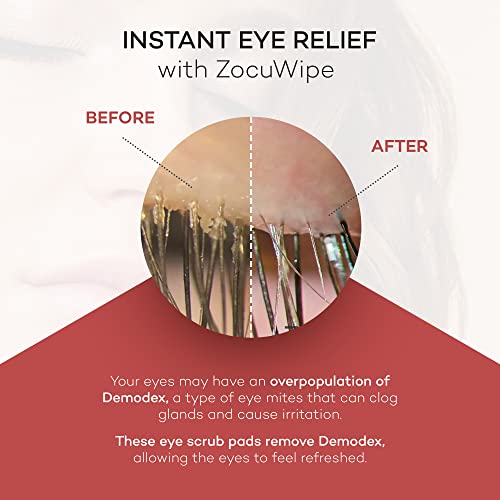 Zocular Zocuwipe Eyelid Wipes with Natural Okra Complex – Eyelid Cleanser & Moisturizer Pads (40ct)