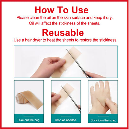 ZODENIS Silicone Scar Sheets – 1.6” x 120” Roll (3M) for Scar Care