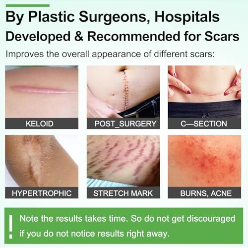 ZODENIS Silicone Scar Sheets – 1.6” x 120” Roll (3M) for Scar Care