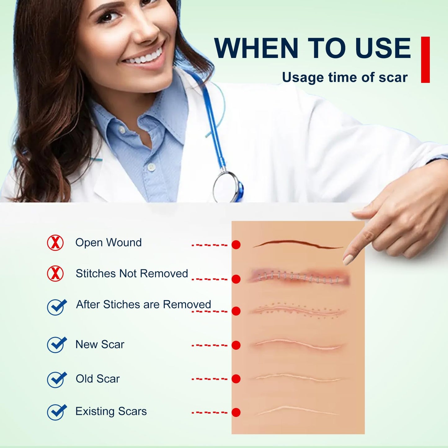 ZODENIS Silicone Scar Sheets – 1.6” x 120” Roll (3M) for Scar Care