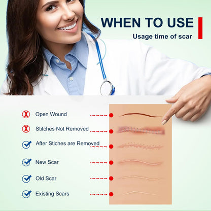 ZODENIS Silicone Scar Sheets – 1.6” x 120” Roll (3M) for Scar Care