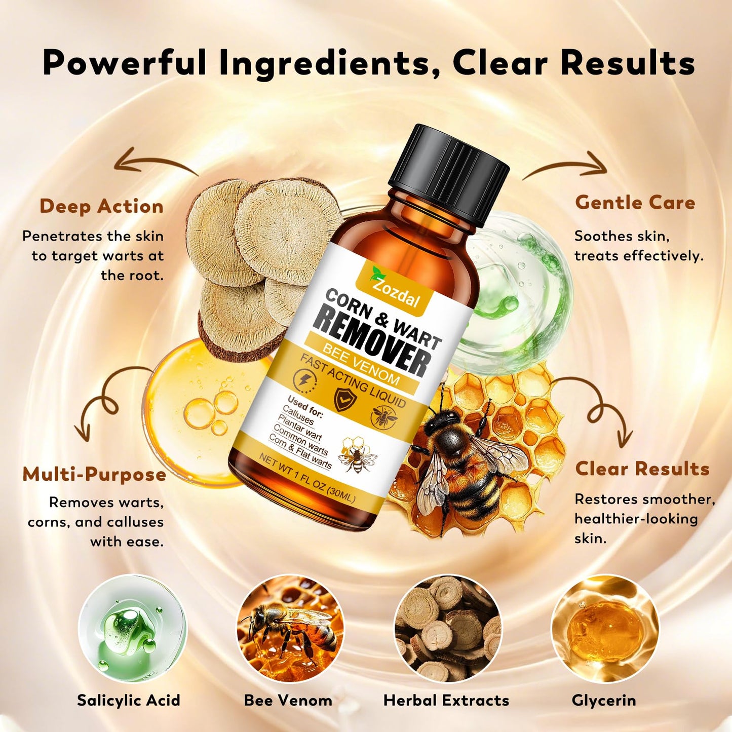 Zozdal Bee Venom Wart Remover 30ml – Dual-Action Salicylic Acid & Bee Venom for Plantar, Common, Flat Warts